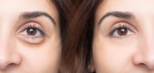 Super Express De-puffing eye treatment